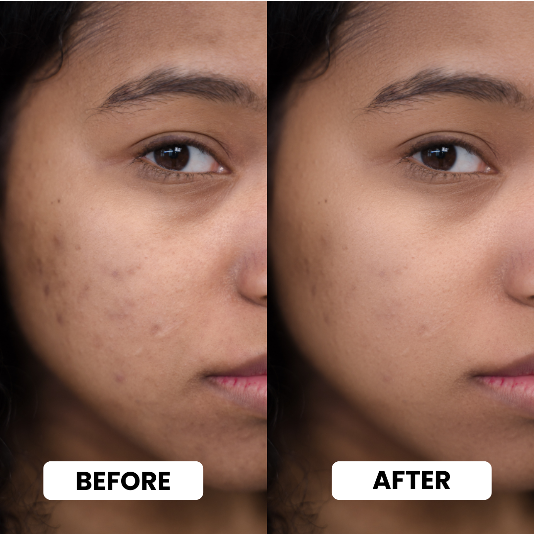 Skin Polish